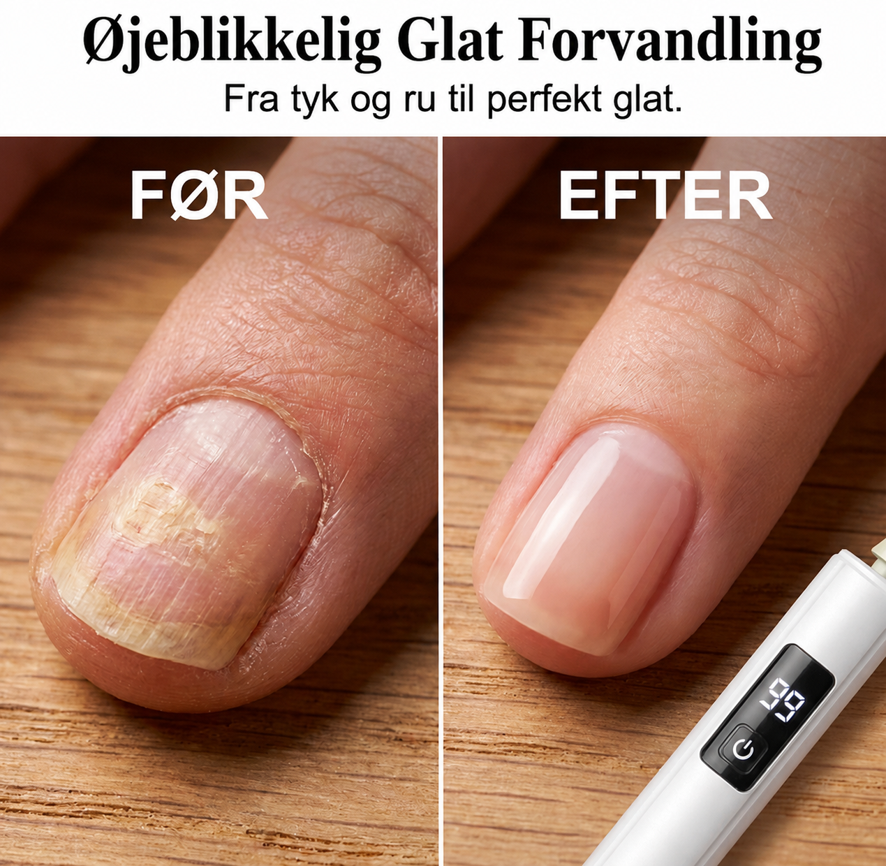 2026 UDSALG! 🥳  💅 Over 50.000 tilfredse kunder! ✨ 50 % RABAT – Kun i en begrænset periode!  Professionel elektrisk neglefil med 99 hastigheder – Perfekt til at forme, udglatte og polere selv tykke negle. Få salonresultater derhjemme. 🌟💎